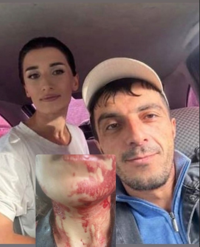 В Дагестане произошла шокирующая история. Молодой мужчина вложил немалую сумму в свою возлюбленную, оплатив ей дорогостоящие сто…
