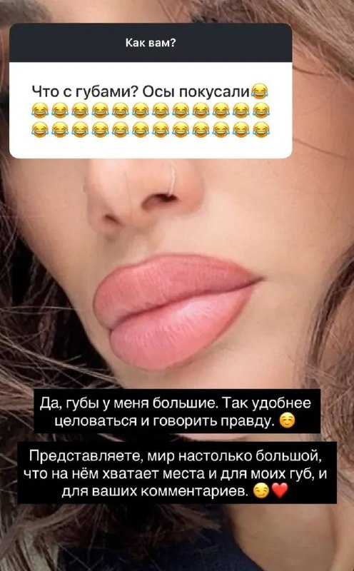 Айза ответила на критику своих губ