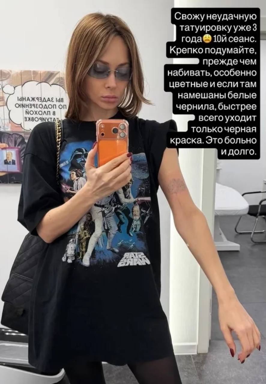 Настасья Самбурская решила избавиться от ошибок молодости!