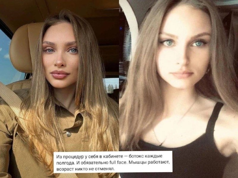Молодая жена бывшего мужа Бородиной не устает радовать своих подписчиков — каждые полгода она делает себе ботокс! Ну что тут ска…