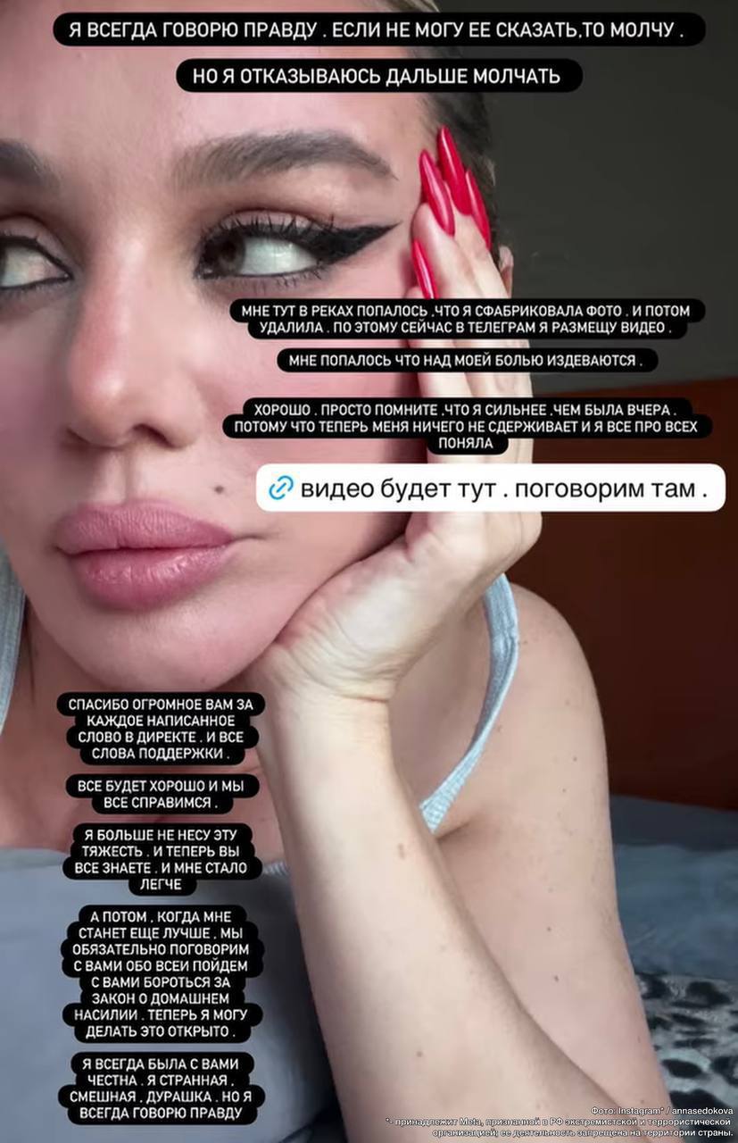 Девочки, вы просто не поверите, что сейчас происходит! Анна Седокова в полном шоке от той лавины хейта, которая обрушилась на не…